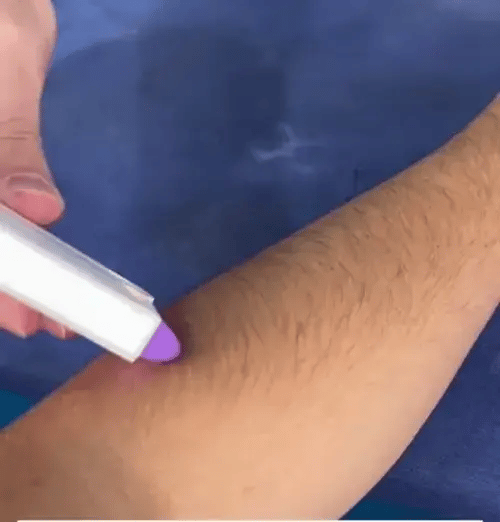 🌸 Depiladora LaserFlex - ✨ Tu piel suave